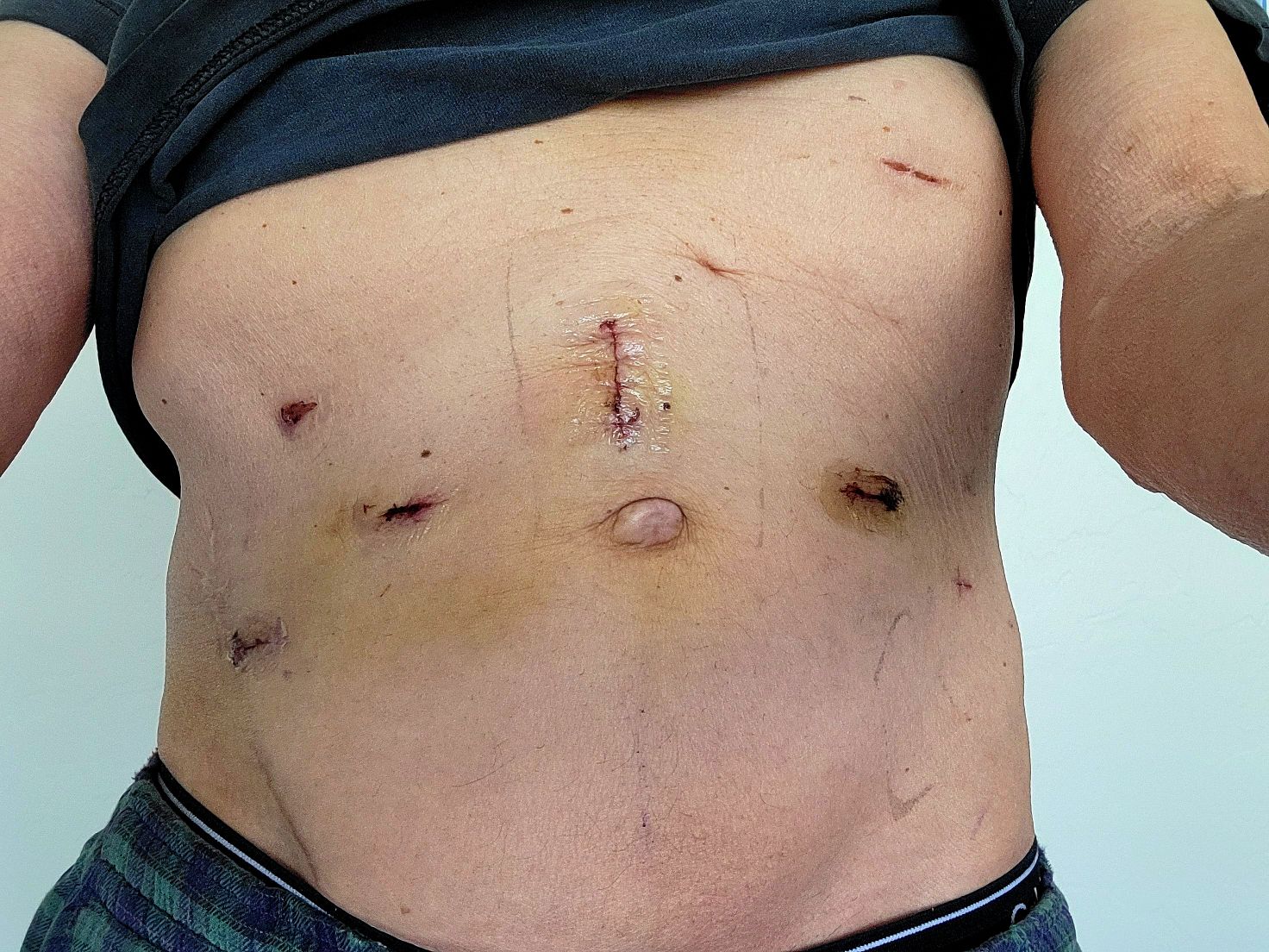surgery scars.jpg